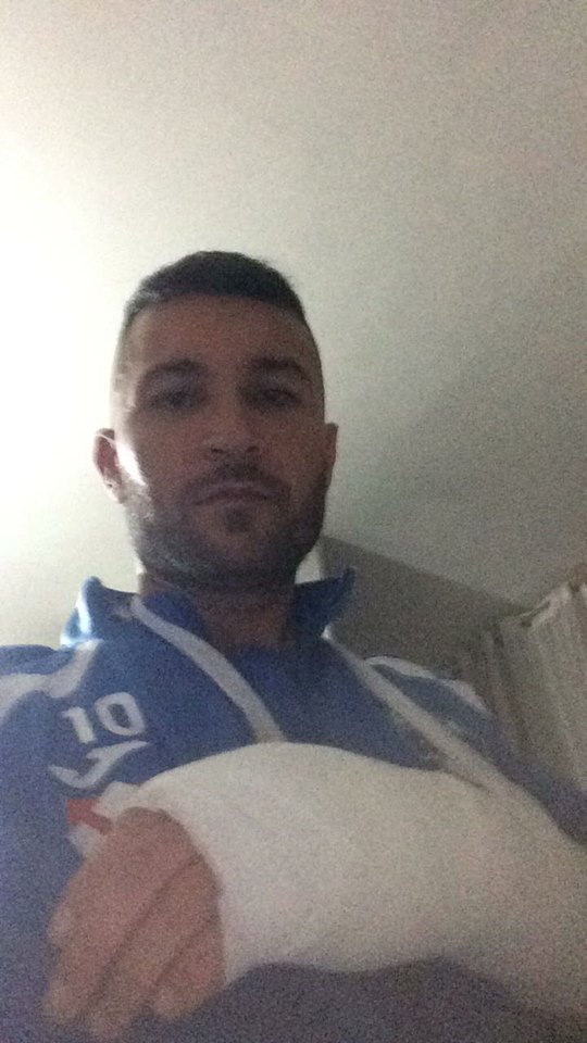 Tegola per il Marcianise, lo storico capitano si frattura la mano