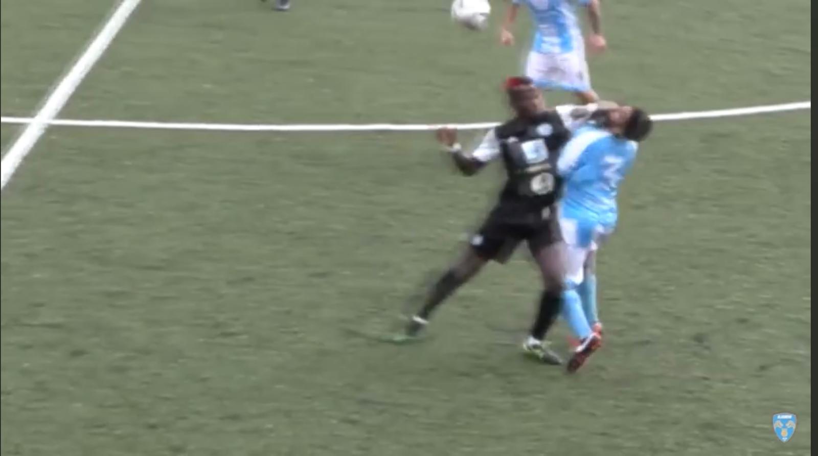 NUOVA NAPOLI NORD, ANCORA TU! L’Albanova denuncia la brutta gomitata sul volto di…